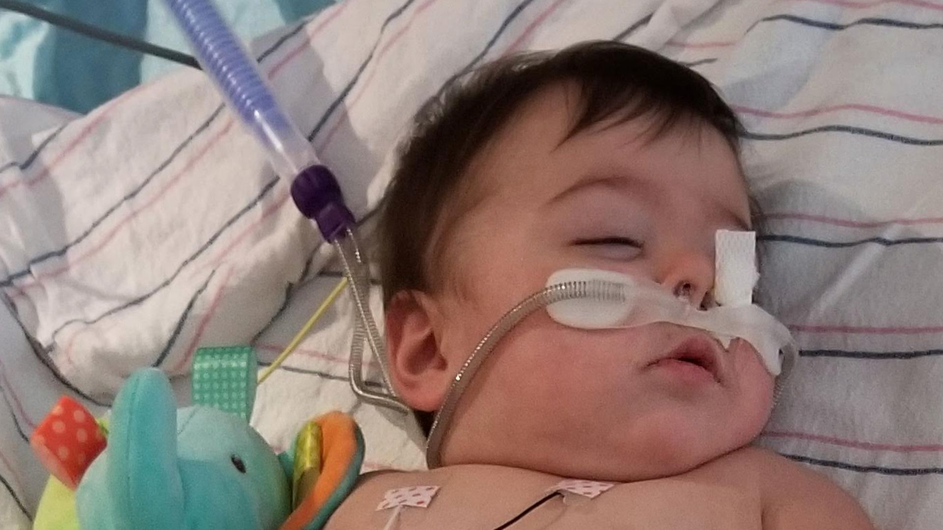 Baby in the hospital on oxygen.